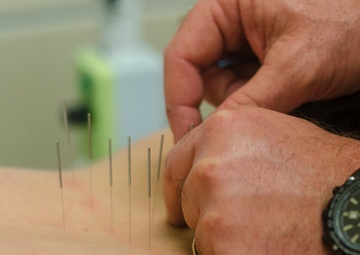 Intrepid Spirit Center tackles TBIs: Yoga, acupuncture part of center’s multidisciplinary approach