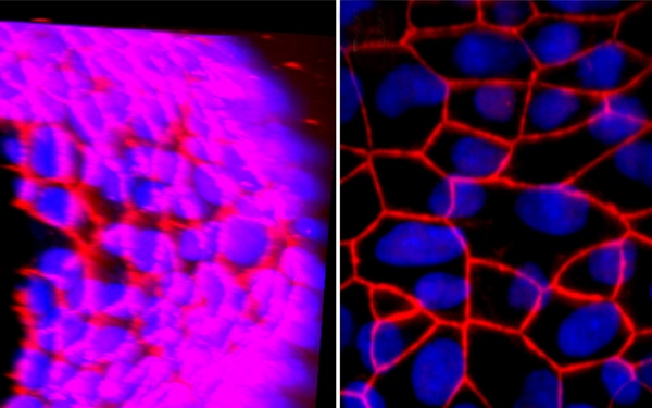 Brain Rescue: Recovery From Neurological Attack