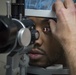 First Small Incision Lenticular Extraction (SMILE) procedure at Naval Medical Center