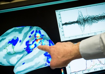 Air Force medical leaders partner with joint forces, DoD researchers on Warfighter Brain Health Initiative