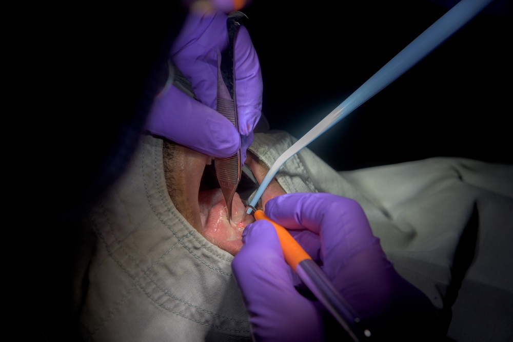 USS Ronald Reagan's Dental Department Performs First Oral-Laser Surgery