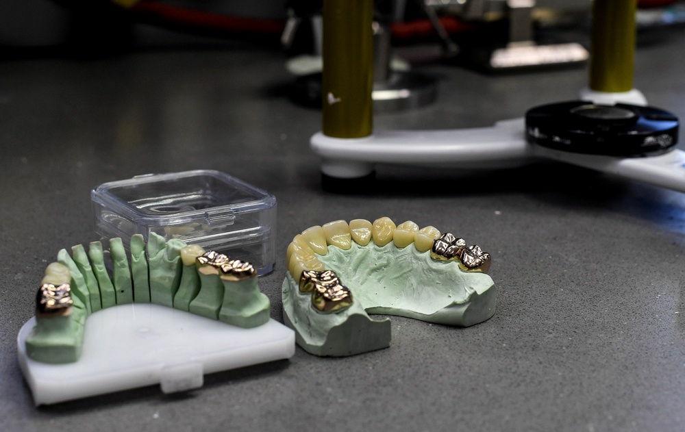 Ramstein Area Dental Lab provides smiles for Airmen, Soldiers