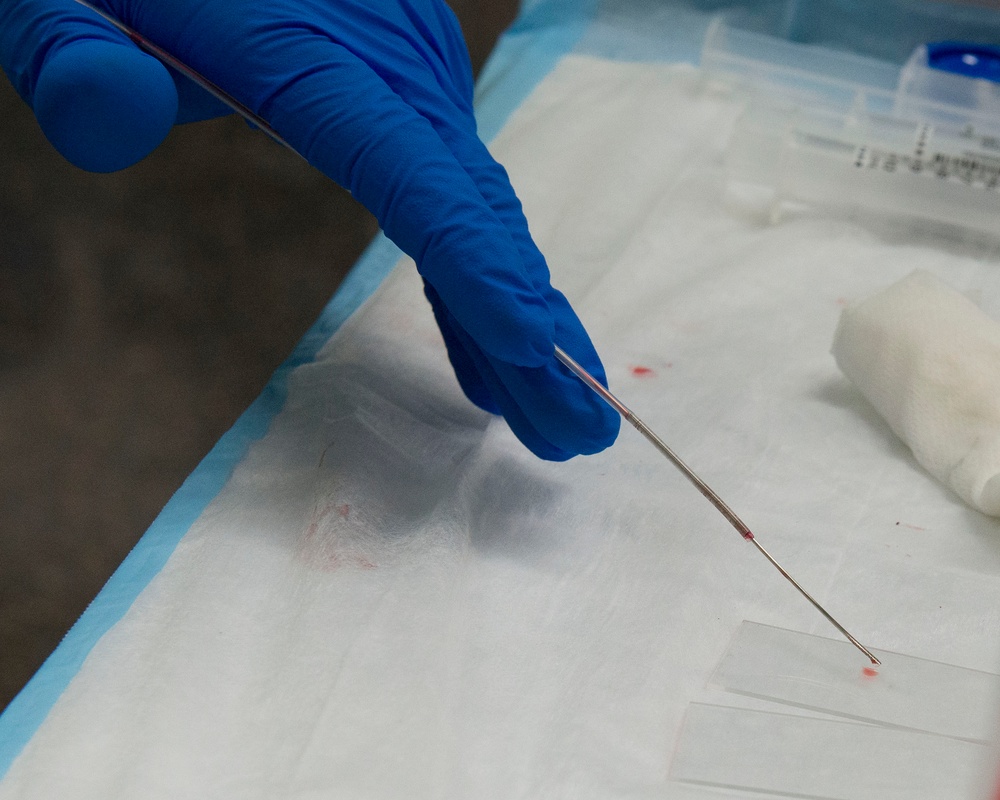 The 88th Medical Operations Squadron perform an Endobronchial Ultrasound Sampling Fine Needle Aspirate procedure inside the operating room at Wright-Patt