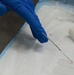 The 88th Medical Operations Squadron perform an Endobronchial Ultrasound Sampling Fine Needle Aspirate procedure inside the operating room at Wright-Patt