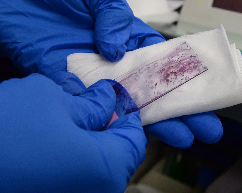 The 88th Medical Operations Squadron perform an Endobronchial Ultrasound Sampling Fine Needle Aspirate procedure inside the operating room at Wright-Patt