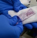The 88th Medical Operations Squadron perform an Endobronchial Ultrasound Sampling Fine Needle Aspirate procedure inside the operating room at Wright-Patt