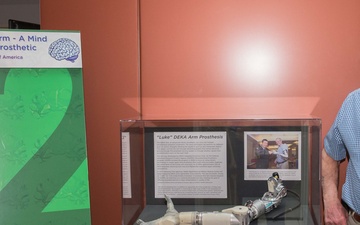 Advanced Bionic Prosthetic Arm Added to Medical Museum Collection