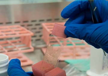 Wright-Patt's cytology lab examines cells to help make clear diagnosis