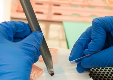 Wright-Patt's cytology lab examines cells to help make clear diagnosis