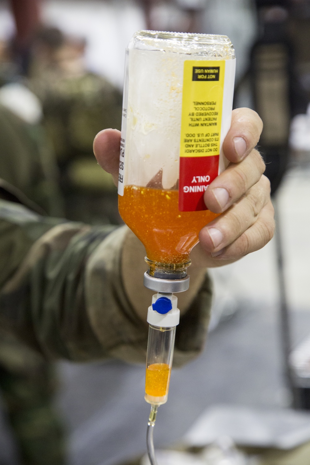 Rugged blood for rugged men: freeze-dried plasma saves a SOF life