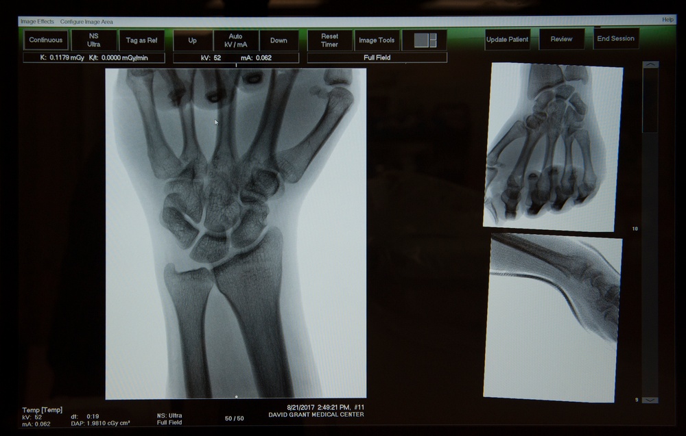 Orthopedic Hand Clinic, David Grant U.S. Air Force Medical Center