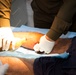 Iraqi medical staff member with Coalition support provide medical care at Taji