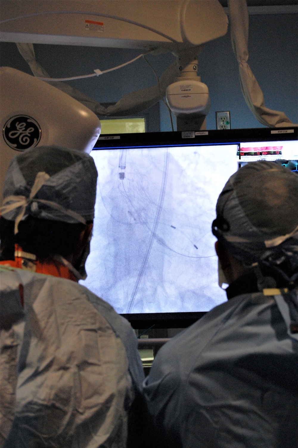 WBAMC doctors perform first TAVR in El Paso