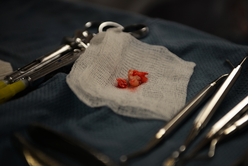 Taking care of pearly whites