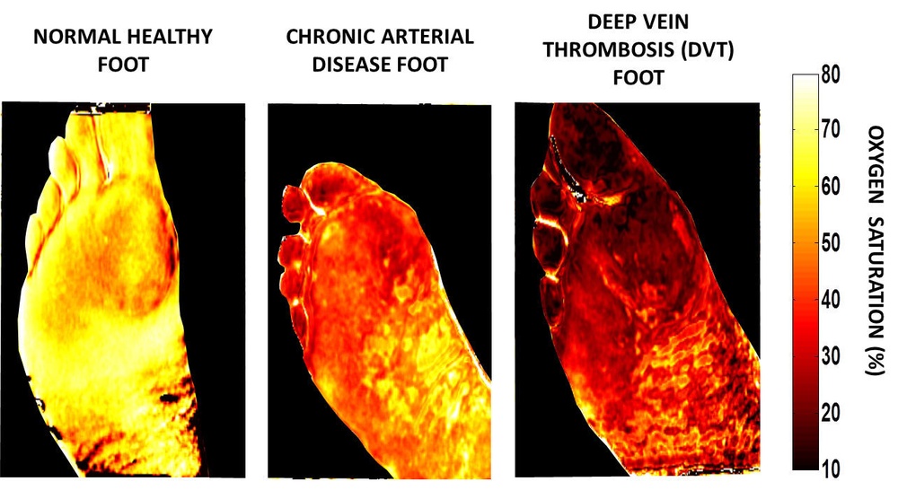 dvids-images-a-clear-picture-image-1-of-5