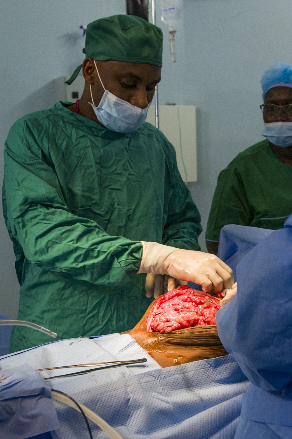 Senegalese Army Surgeon Begins Removing Tumor
