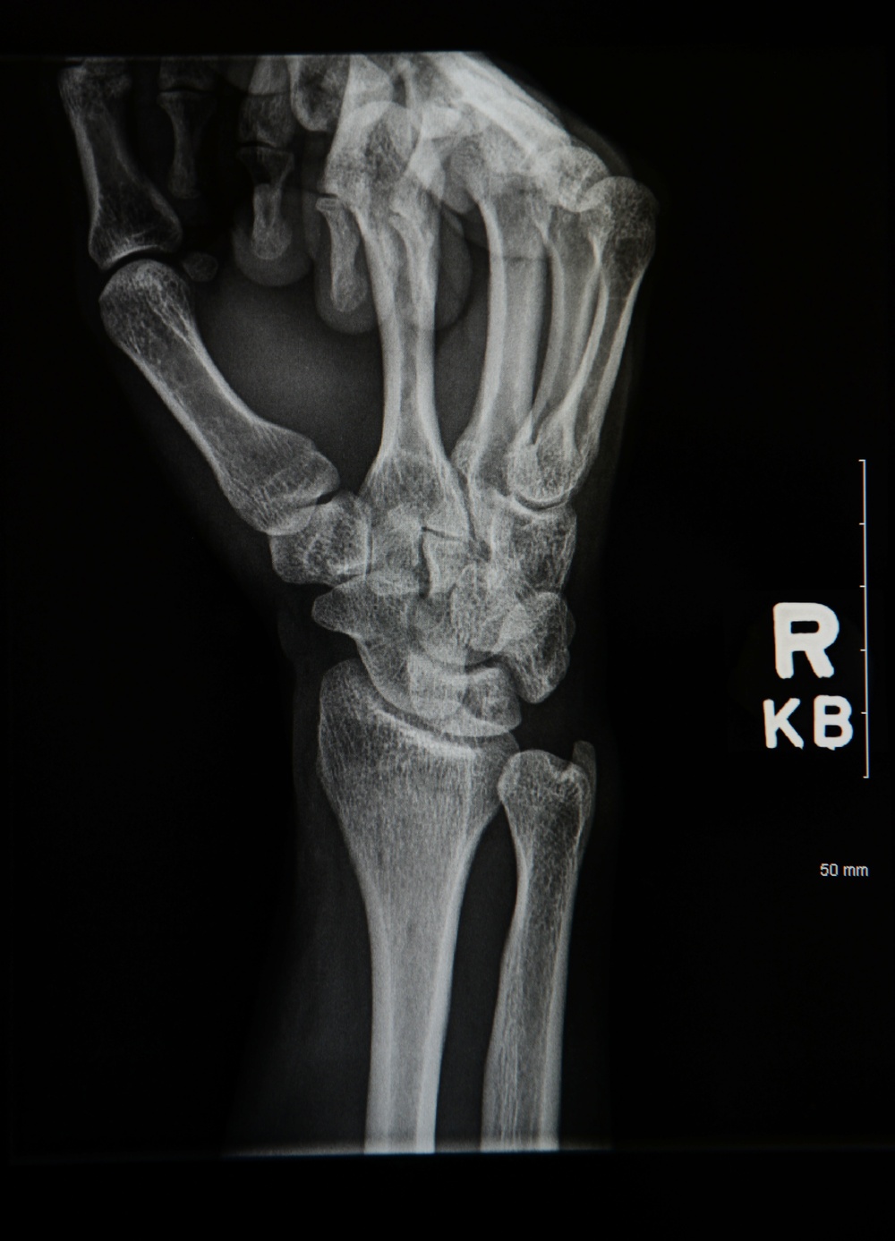 Radiology Technologist; the Middle Man