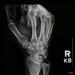 Radiology Technologist; the Middle Man