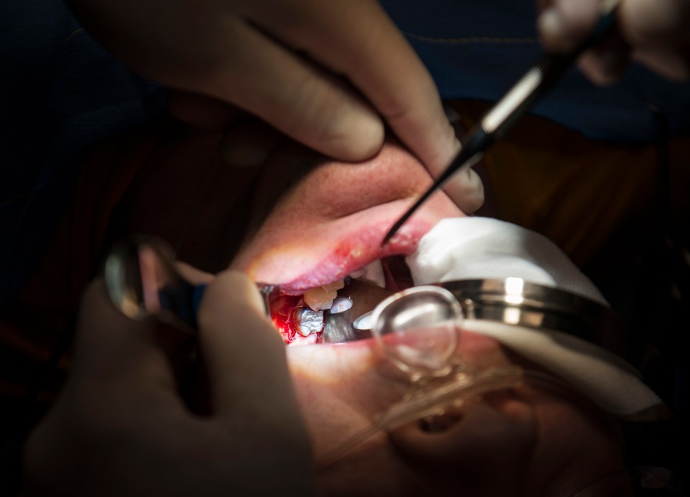 GHWB Dental Officer Performs Oral Surgery