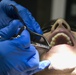 31st MEU dental officer extracts wisdom teeth while underway