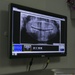 31st MEU dental officer extracts wisdom teeth while underway