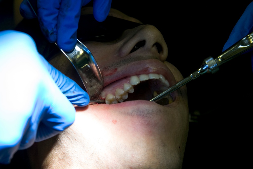 31st MEU dental officer extracts wisdom teeth while underway