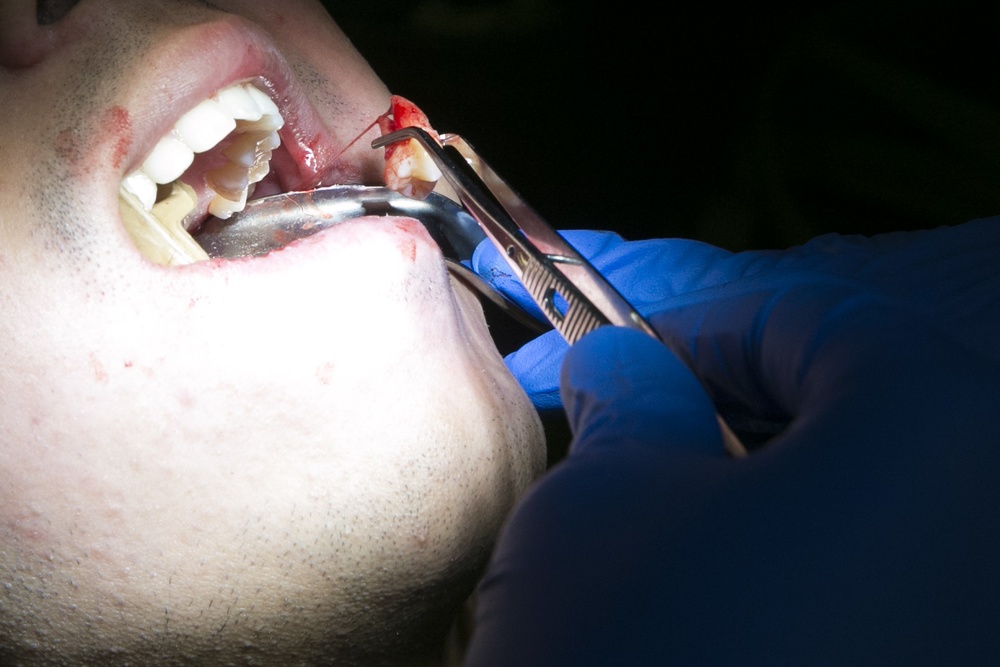 31st MEU dental officer extracts wisdom teeth while underway
