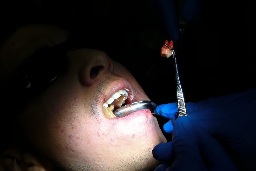 31st MEU dental officer extracts wisdom teeth while underway