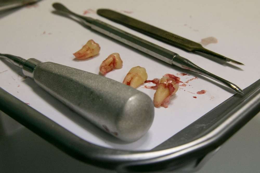 31st MEU dental officer extracts wisdom teeth while underway