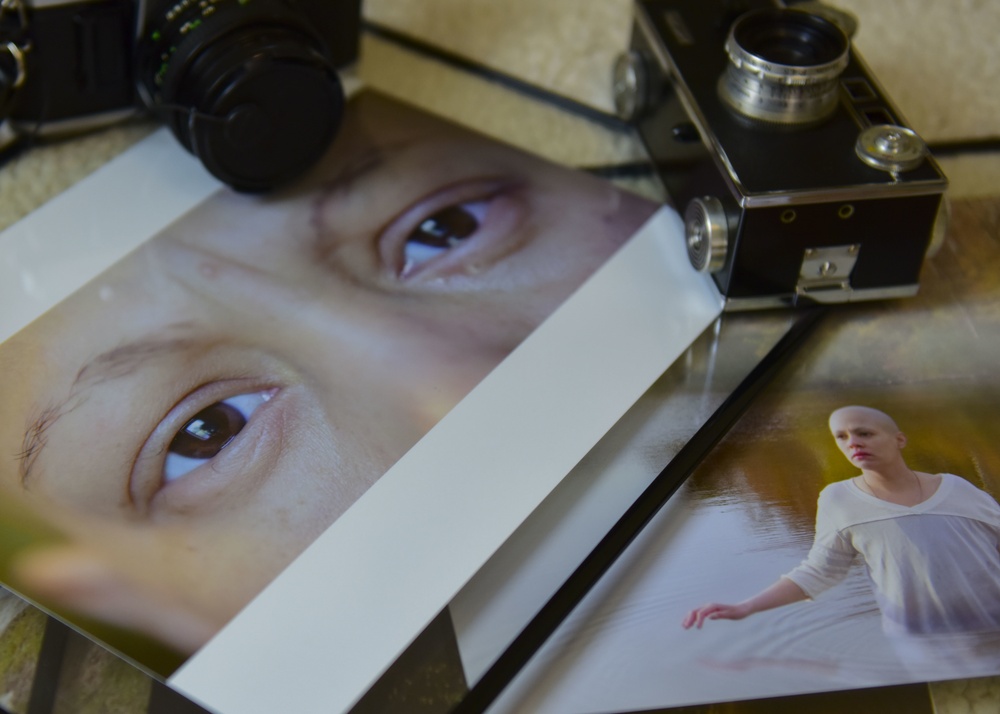 Blurred Vision: A Soldier’s lonely battle with cancer