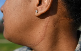 Strength in recovery: victim becomes advocate