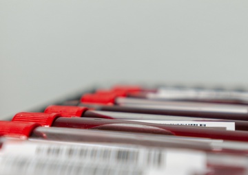 Freedom runs through those viens