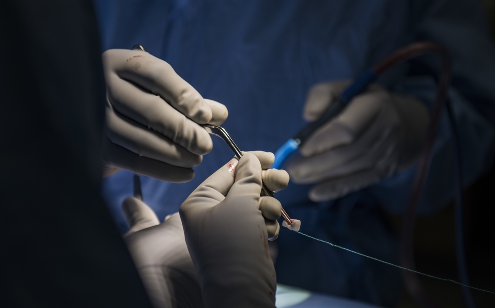 99th MDG: The backbone of AF spine surgery