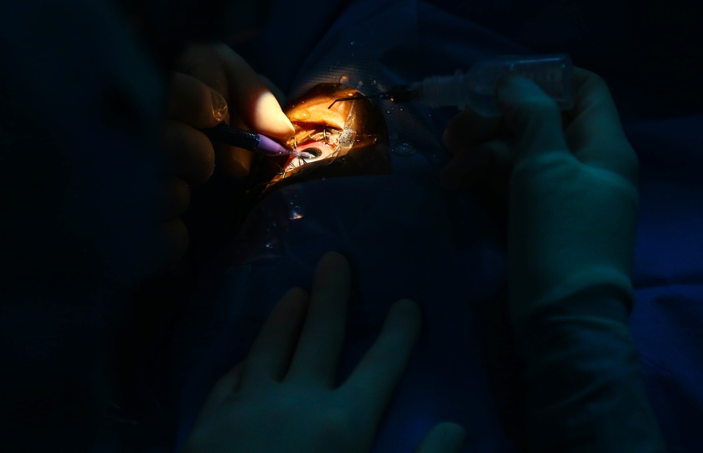 USNS Comfort Surgeons Perform a Cataract Surgery