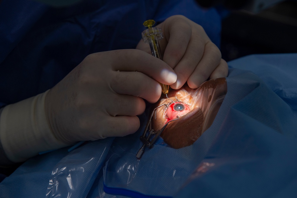 USNS Comfort Surgeons Perform a Cataract Removal Surgery