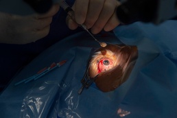 USNS Comfort Surgeons Perform a Cataract Removal Surgery