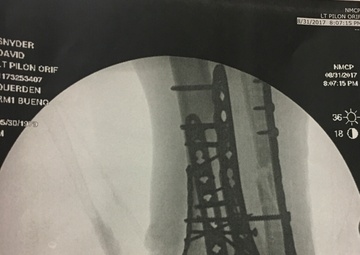 One-foot step at a time