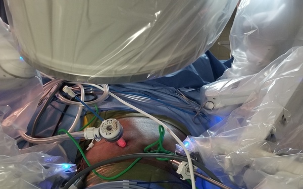 First of its kind procedure minimizes recovery, surgeries for some WBAMC patients