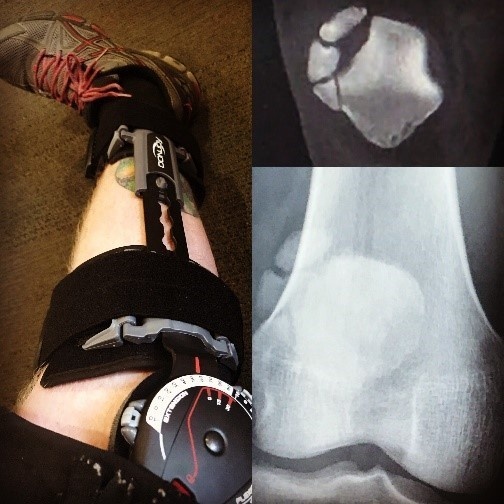 Soldier says you’re not less of a person for landing in a WTU