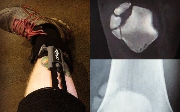 Soldier says you’re not less of a person for landing in a WTU