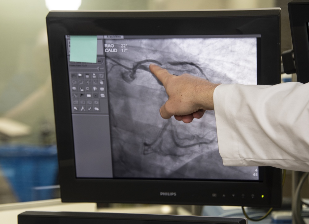 Cardiology Consult, DGMC