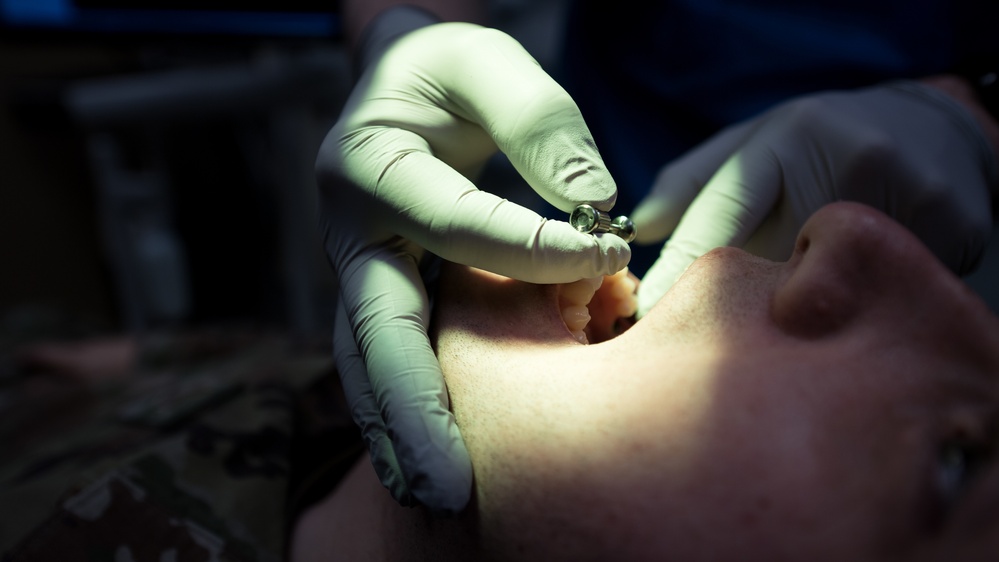 Residency program provides Airmen dental implant options