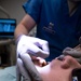 Residency program provides Airmen dental implant options