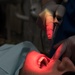 Residency program provides Airmen dental implant options