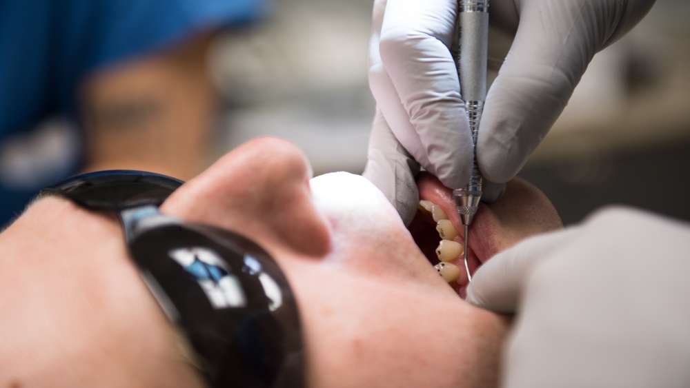 Residency program provides Airmen dental implant options