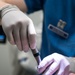 Residency program provides Airmen dental implant options