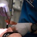 Residency program provides Airmen dental implant options