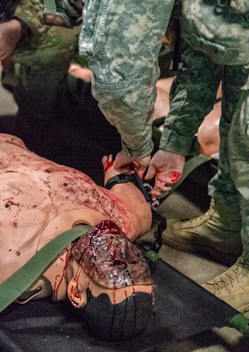 West Virginia Army National Guard Combat Medics Train at Camp Dawson