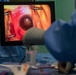 Week one of ophthalmology surgeries at New Horizons 2019 conclude