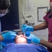 Tooth removal